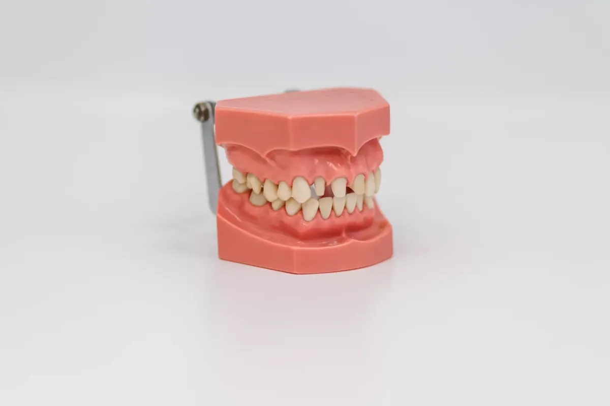 Dentadura