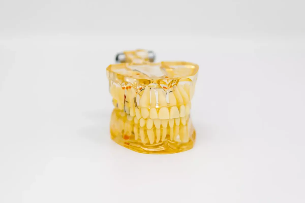 Dentadura