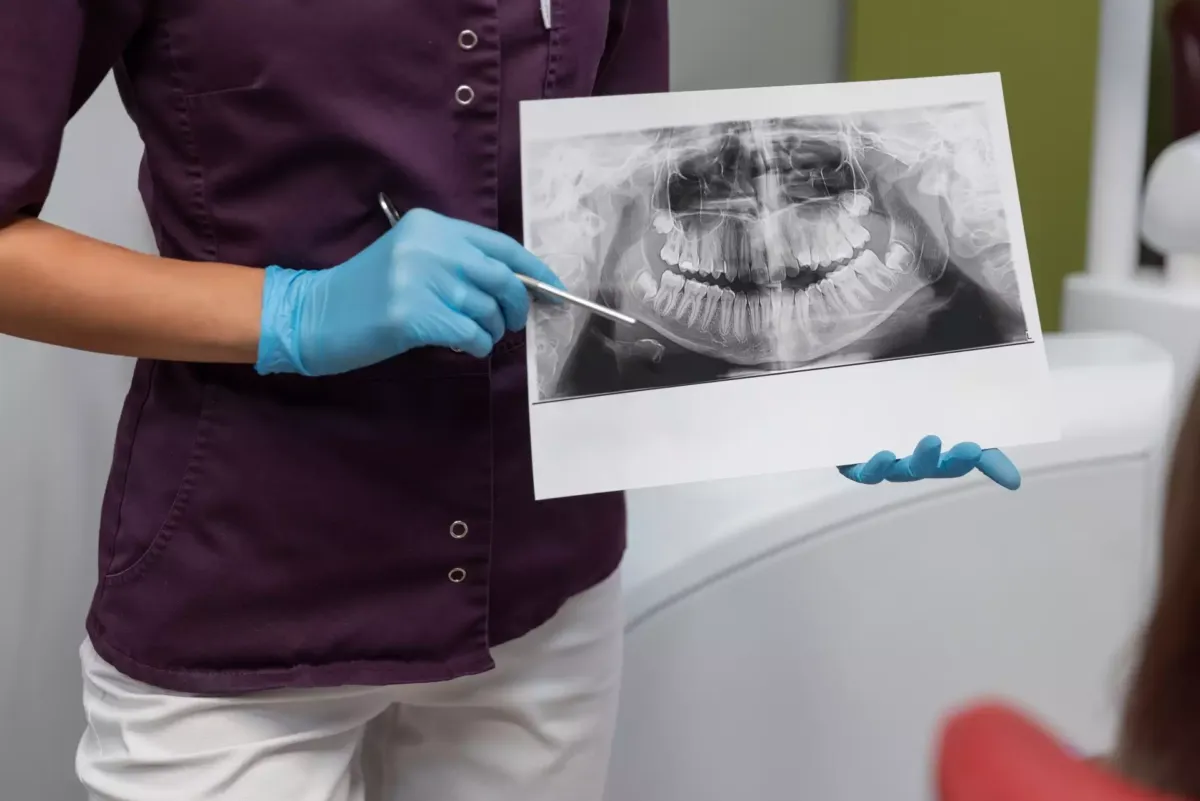 Mujer sujetando una radiografía bucal